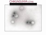 virus chikungunya