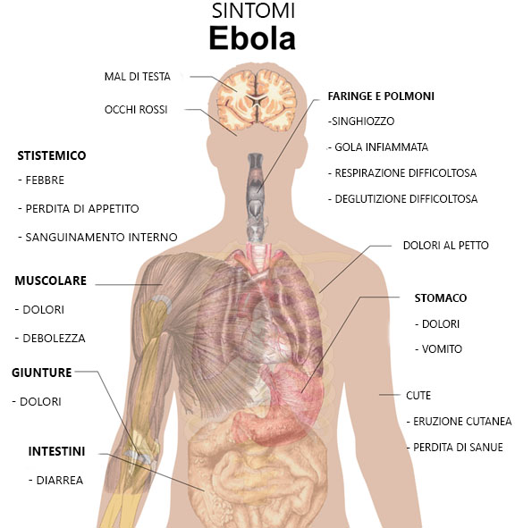 Ebola symptoms