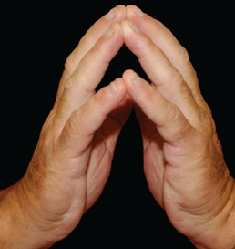 Sindrome della mano diabetica Sindrome della mano diabetica