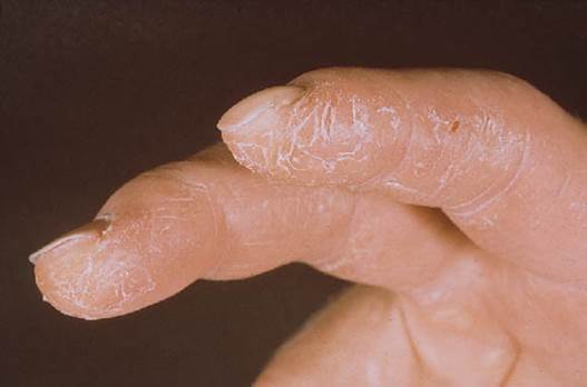 Mechanic’s hands Mechanic’s hands