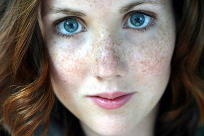 Freckle | Define Freckle at Dictionary.com