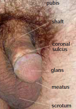 balanitis balanitis