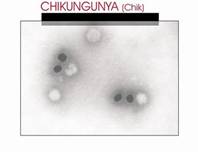 Chikungunya virus
