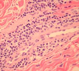 Histologic sections Histologic sections