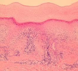 Histologic sections Histologic sections
