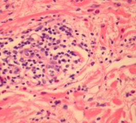 Histologic sections Histologic sections