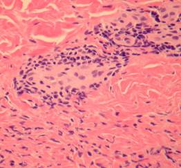 Histologic sections Histologic sections