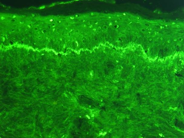 Immunofluorescence Immunofluorescence