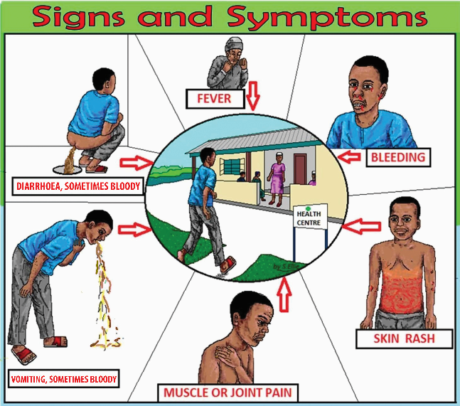 Ebola symptoms