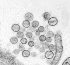 Visione al microscopi di Hantavirus