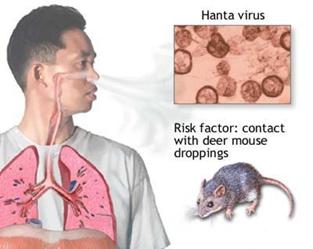 Metodo di trasmissione di Hantavirus