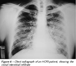 Radiografie Radiografie