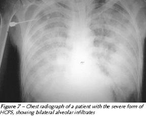 Radiografie